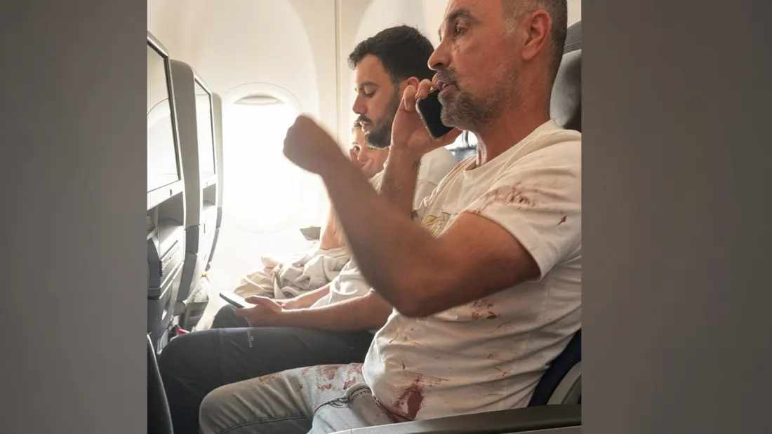 Passengers Stormed the Cockpit on a Dubai–Tel Aviv Flight After a Pilot Stabbing Sent the Jet into a Dive