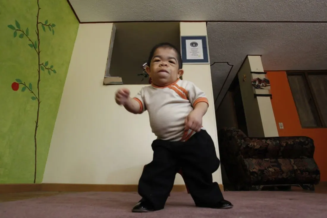 Edward Niño Hernandez: The Bogotá Man Who Held the World's Shortest Man Title Twice